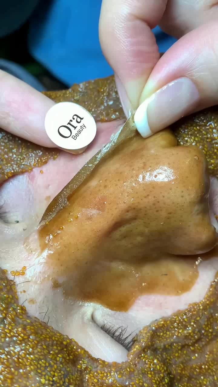 Gold gel still covering the nose at the start of the recorded peel