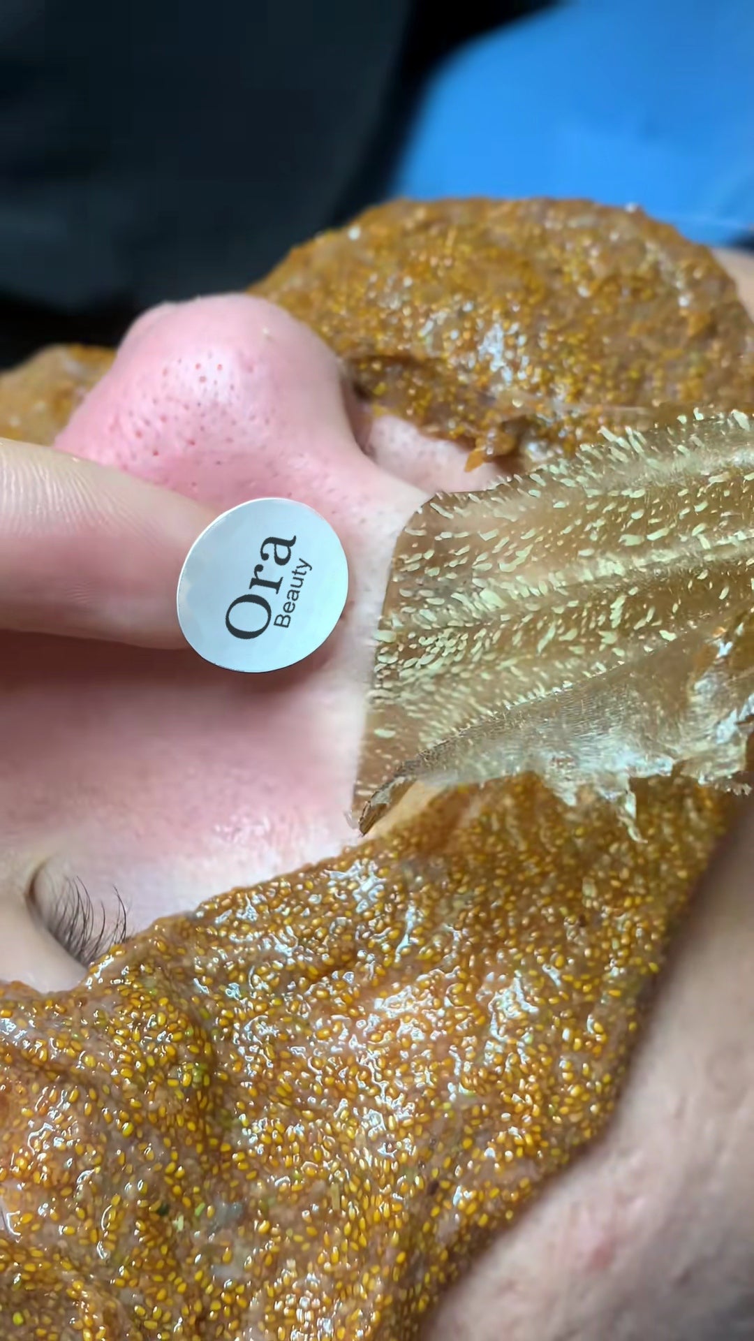 A close-up of the texture visible on the lifted gel.