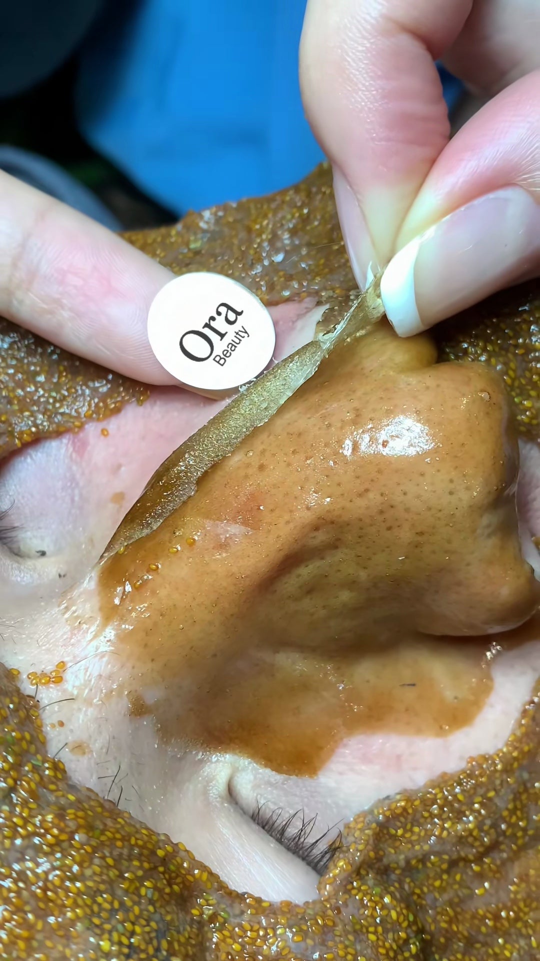 The edge of the gel is lifted from the nose.
